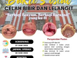 Operasi Bibir Sumbing dan Lelangit Gratis Kembali Digelar, Pendaftaran Buka Hingga 26 Juni